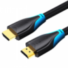 VENTION HDMI AACBH Cable 2M Black